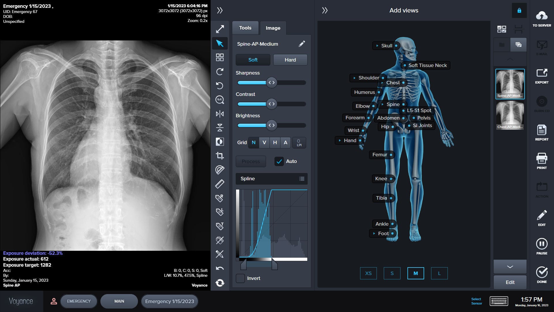 Radiologist reviewing X-ray images on a diagnostic monitor