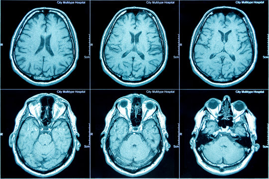 CT scan diagnostic report showing detailed radiology analysis